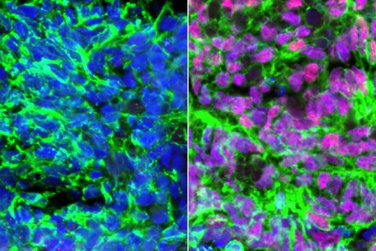In rosa gli interneuroni del tatto prodotti in laboratorio (fonte: UCLA Broad Stem Cell Research center/Stem Cell Reports) - RIPRODUZIONE RISERVATA