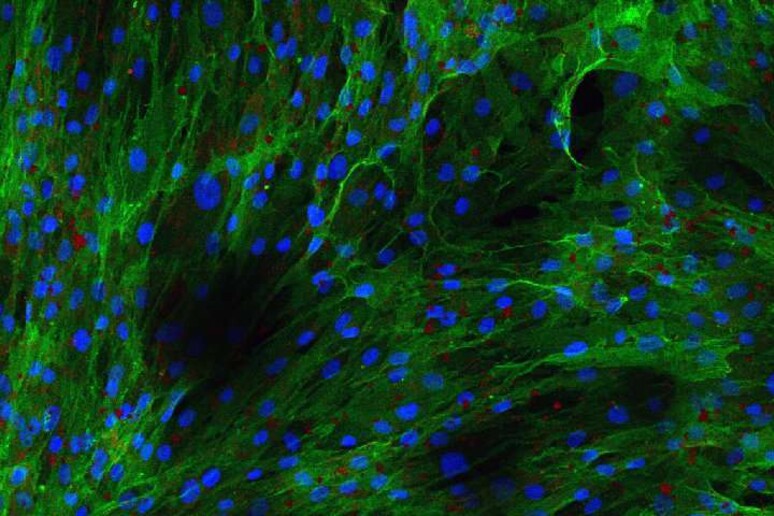 Cellule staminali umane, in verde (fonte: John R. Bracht) - RIPRODUZIONE RISERVATA